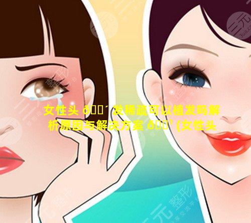 女性头 🐴 发稀疏可以植发吗解析原因与解决方案 🌹 (女性头发稀疏可以植发吗解析原因与解决方案有关吗)